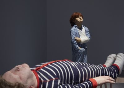 Two lifelike human sculptures. One person is lying down. The other has a broken arm